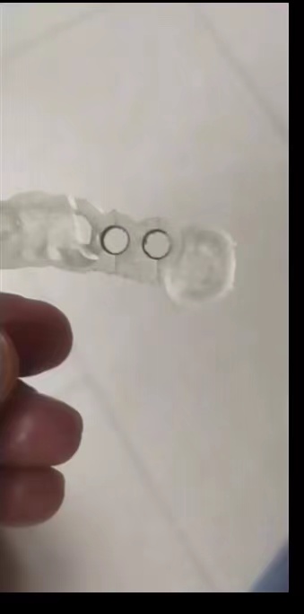 Guide de plantation d'impriman - 3D Printing Guide avis et prix